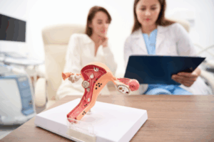 How Wegovy can help with polycystic ovary syndrome (PCOS)