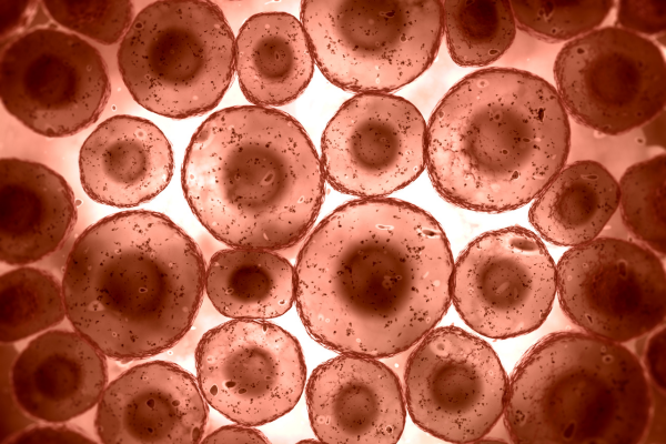 Do Fat Cells Enlarge and Burst with Rapid Weight Gain?