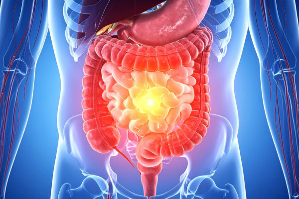 Leaky Gut
